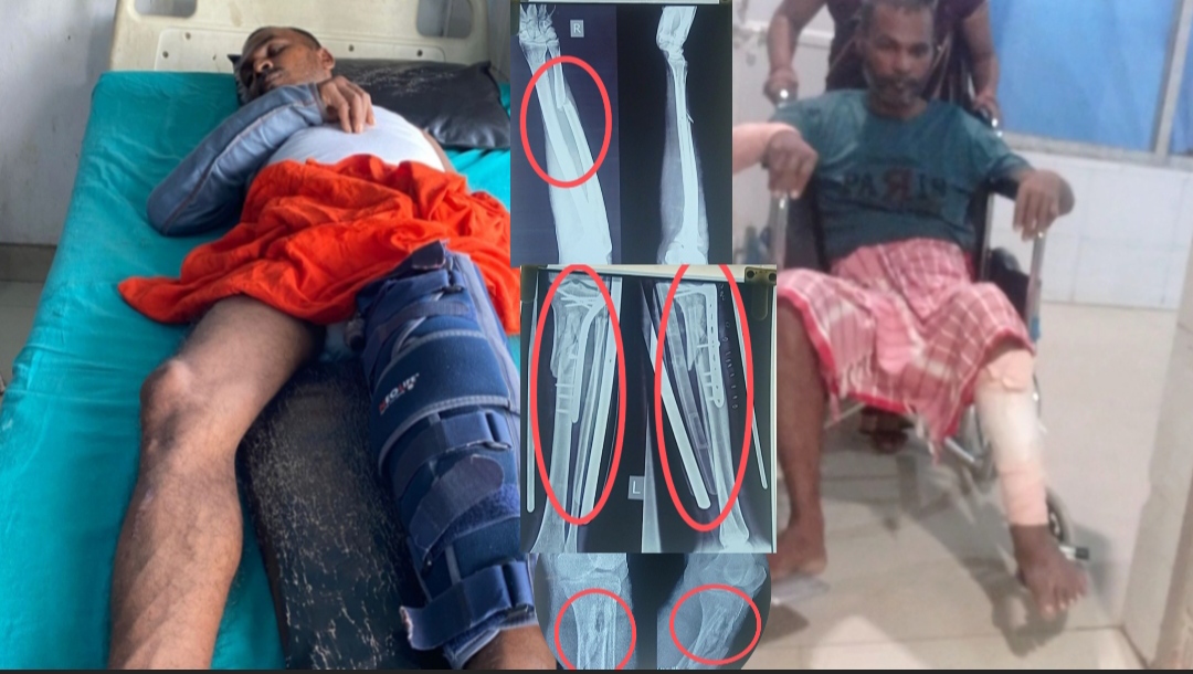 मानसिक अवस्था कमजोर गरिब लचार बुवामाथि निर्मम कुटपिट, उपचारमा ६ लाख सकियो — छोरीको पुकार: “अब बुवालाई बचाउने आशा सहयोगमै छ